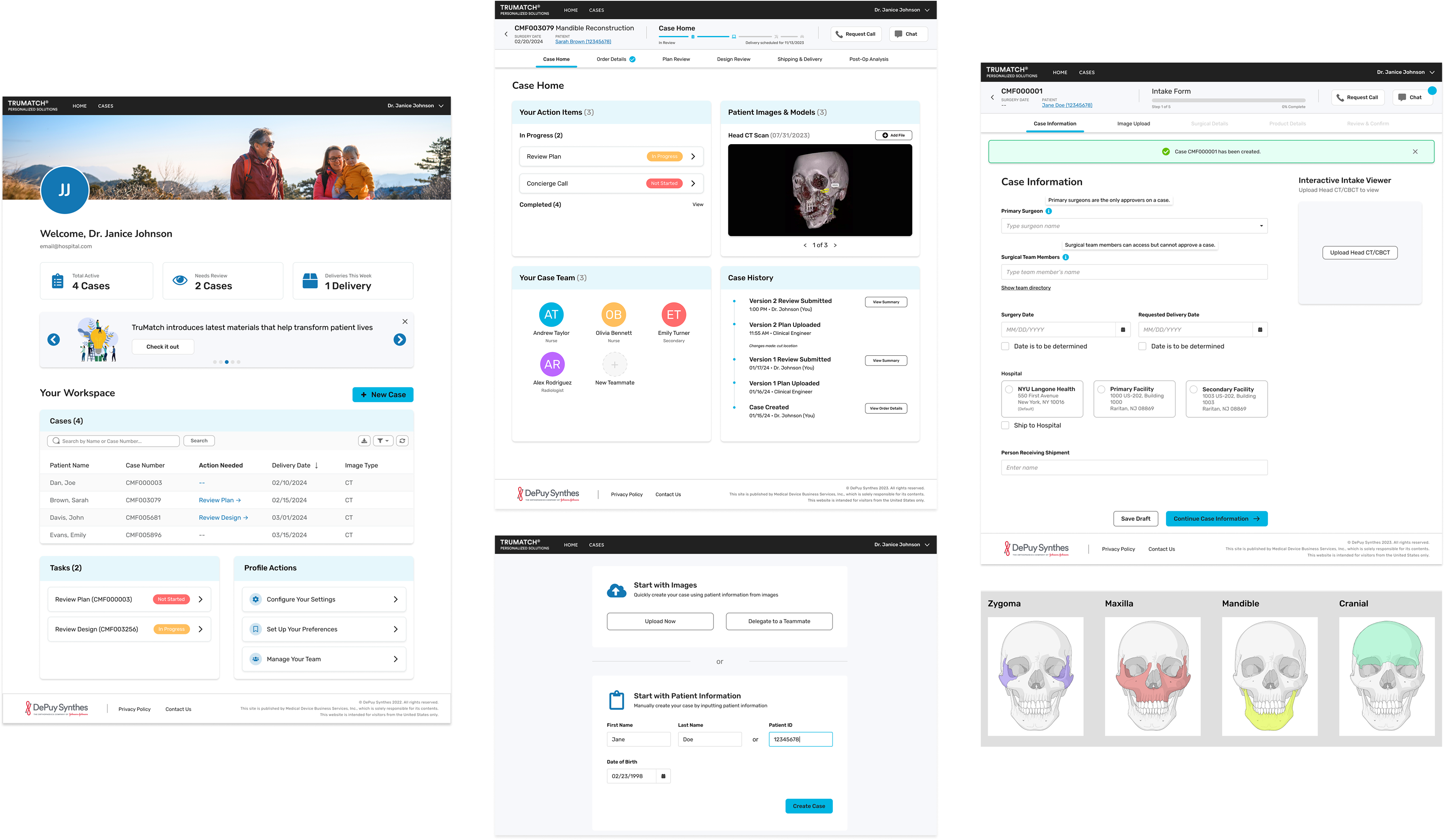 Hi-Fidelity Designs: Dashboard, Cases, Intake, Implant Viewer